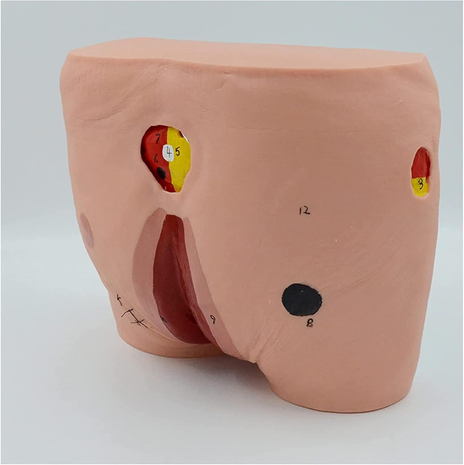 Human Wound Care Model Bedsore Nursing Human Model Pressure Ulcers Manikin Teaching Human Simulator for Nursing Teaching