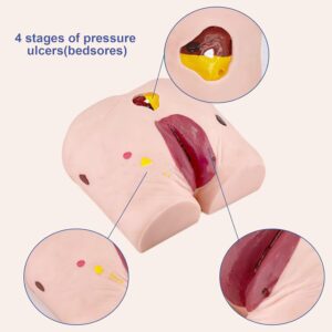 Human Wound Care Model Bedsore Nursing Human Model Pressure Ulcers Manikin Teaching Human Simulator for Nursing Teaching