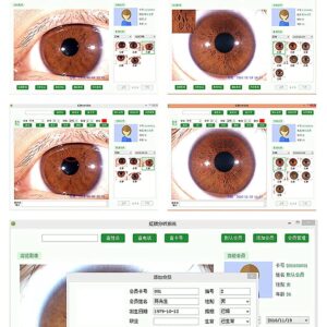 QXIUDDYS Iridology Camera Analyzer, Iris Analysis Camera, 5.0 MP USB Iris Analyzer Iridology Camera, Eye Iridology Camera, HD 30x Iris Lens and Driver-Free Analysis Software