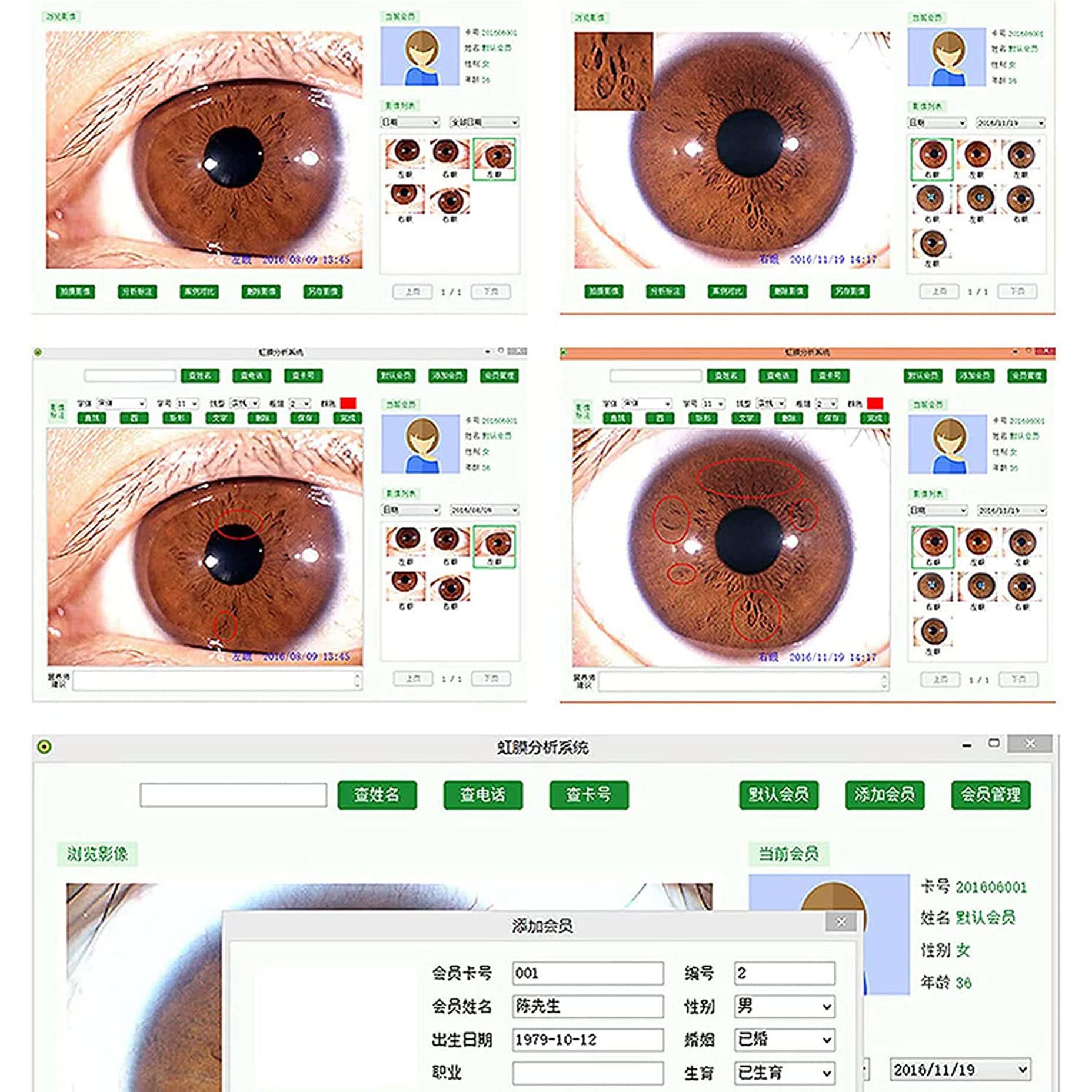 QXIUDDYS Iridology Camera Analyzer, Iris Analysis Camera, 5.0 MP USB Iris Analyzer Iridology Camera, Eye Iridology Camera, HD 30x Iris Lens and Driver-Free Analysis Software