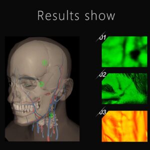 Vein Finder, Portable Blood Vessel Finder, Medical Vein Image Display Instrument, Infrared Vein Finder Viewer Light with 5 Modes for Elderly Adult Children Easy Finding Subcutaneous Veins