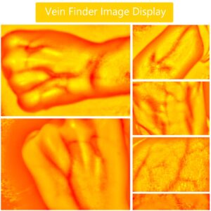 Vein Finder, Portable Blood Vessel Finder, Medical Vein Image Display Instrument, Infrared Vein Finder Viewer Light with 5 Modes for Elderly Adult Children Easy Finding Subcutaneous Veins