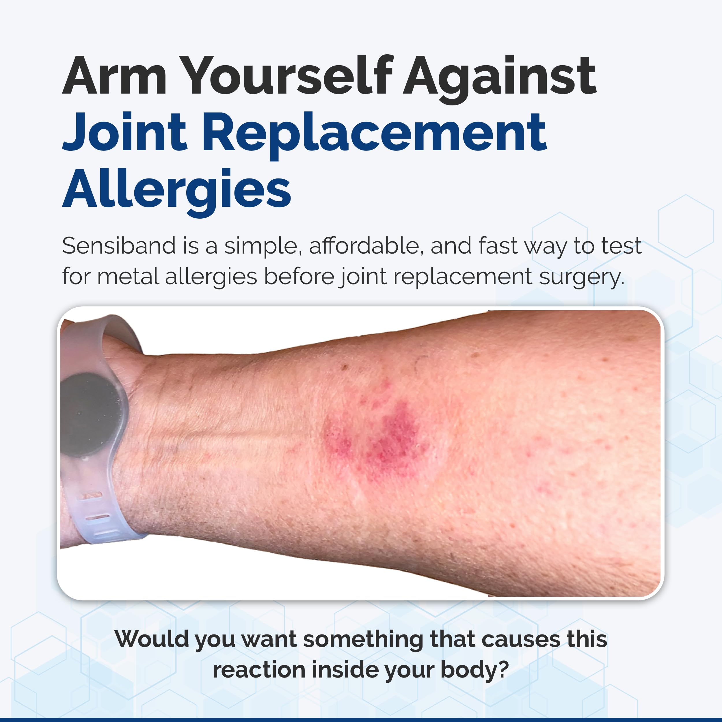 SENSIBAND Metal Allergy Test Band – Test at Home or Anywhere - Tests for Common Metals Used in Piercings & Jewelry - See Your Own Results - Order 3 Weeks Before Surgery.… (Copper)