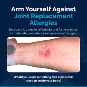 SENSIBAND Metal Allergy Test Band – Test at Home or Anywhere - Tests for Common Metals Used in Piercings & Jewelry - See Your Own Results - Order 3 Weeks Before Surgery.… (Copper)