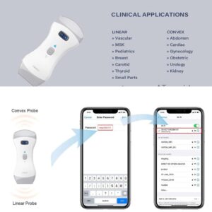 CONTEC Veterinary Wireless Ultrasound Handheld Dual for Animals-Probe Color Doppler Diagnostic System 32 Channel Rechargeable.Suitable for Home,Pets Clinic,Pets Hospital and Other Occasions