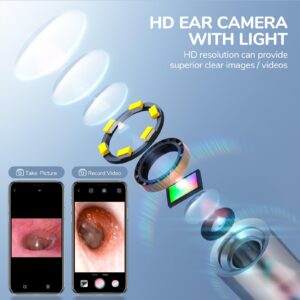 ScopeAround Otoscope, 3.9mm Ultra-Thin Ear Camera with 6 LED Lights, Digital Otoscope with Ear Wax Removal Tool, USB Plug & Play Ear Wax Camera Compatible with iPhone 15/Android