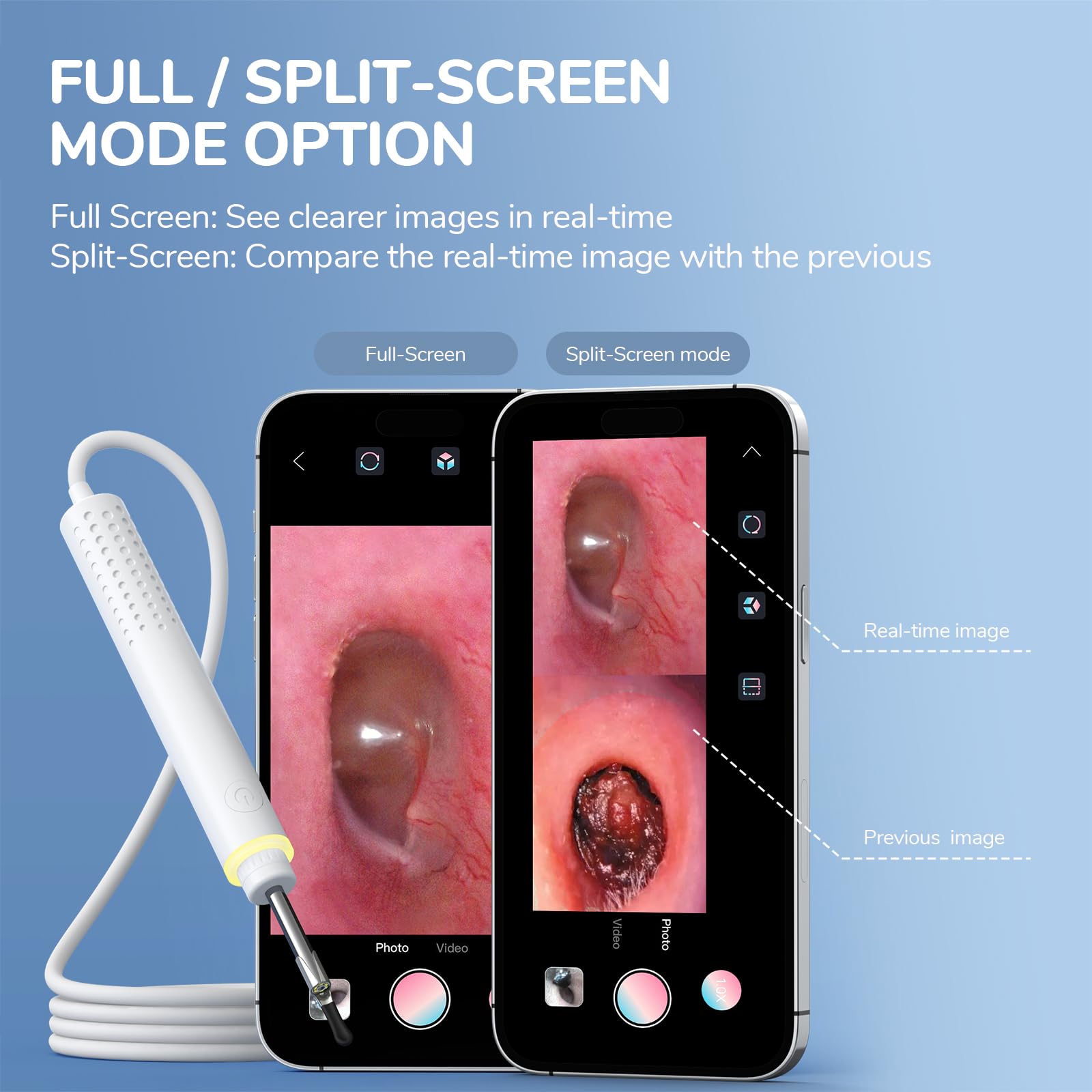 ScopeAround Otoscope, 3.9mm Ultra-Thin Ear Camera with 6 LED Lights, Digital Otoscope with Ear Wax Removal Tool, USB Plug & Play Ear Wax Camera Compatible with iPhone 15/Android