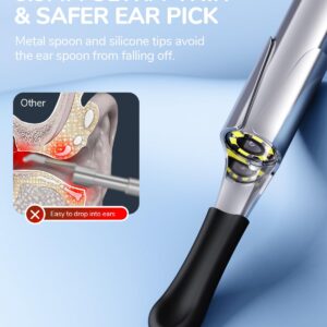 ScopeAround Otoscope Ear Camera, Ear Wax Removal Tool 1080p FHD Video Otoscope, 3.9mm Ear Wax Removal Camera with 6 LED Lights Visual Ear Scope, Compatible with iPhone15 & Android