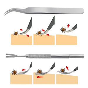 Yogini Stainless Steel Tick Removal Kit,Tick Tweezers, Tick Fork and Portable Storage Case,Tick Removal Tool for Humans and Pets (1 Set)