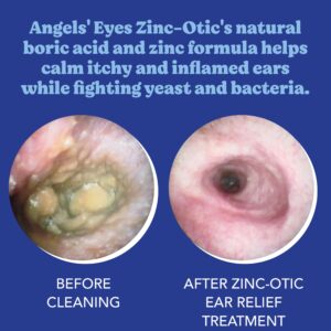 ANGELS’ EYES Zinc-Otic Ear Relief Treatment for Dogs and Cats Soothe Ear Infections Calm Itchy Inflamed Ears Natural BA and Zinc Formula 1 Ounce