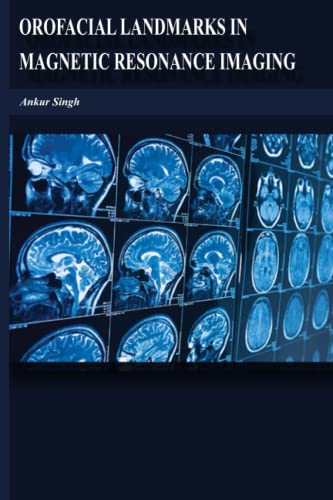 Orofacial Landmarks in Magnetic Resonance Imaging