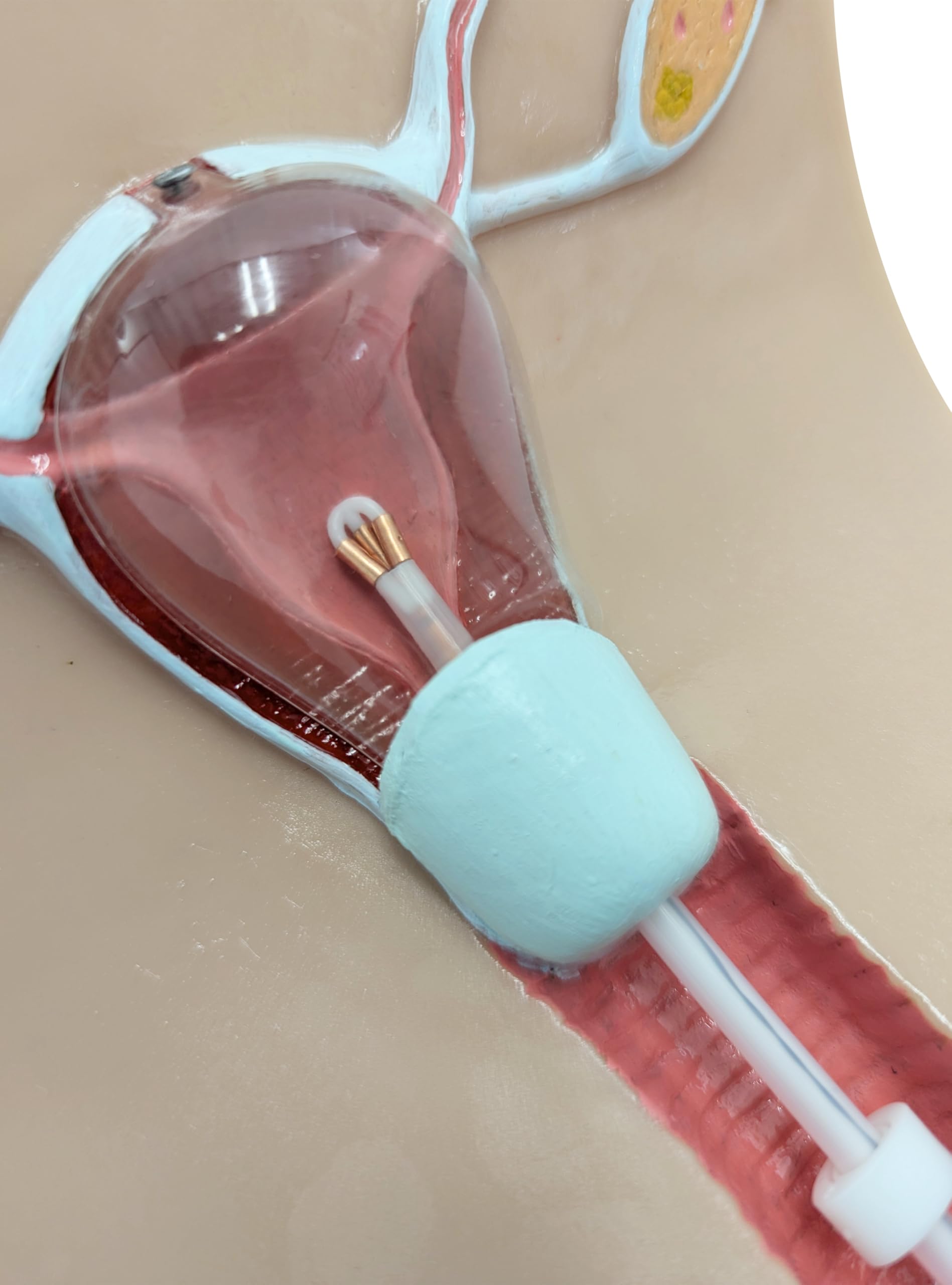 Anatomy Lab IUD Insertion Model I