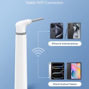 ScopeAround Wireless Otoscope with Light Ear Camera, 3.9mm Ear Wax Removal Tool Camera, 720P HD with 6 LED Lights, WiFi Wireless Otoscope Camera, Ear Scope Compatible with Android and iPhone