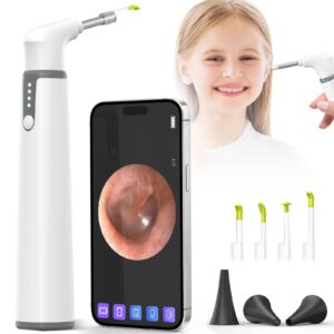 scopearound wireless otoscope with light ear camera, 3.9mm ear wax removal tool camera, 720p hd with 6 led lights, wifi wireless otoscope camera, ear scope compatible with android and iphone