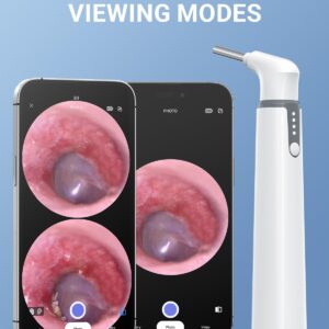 ScopeAround Wireless Otoscope with Light Ear Camera, 3.9mm Ear Wax Removal Tool Camera, 720P HD with 6 LED Lights, WiFi Wireless Otoscope Camera, Ear Scope Compatible with Android and iPhone