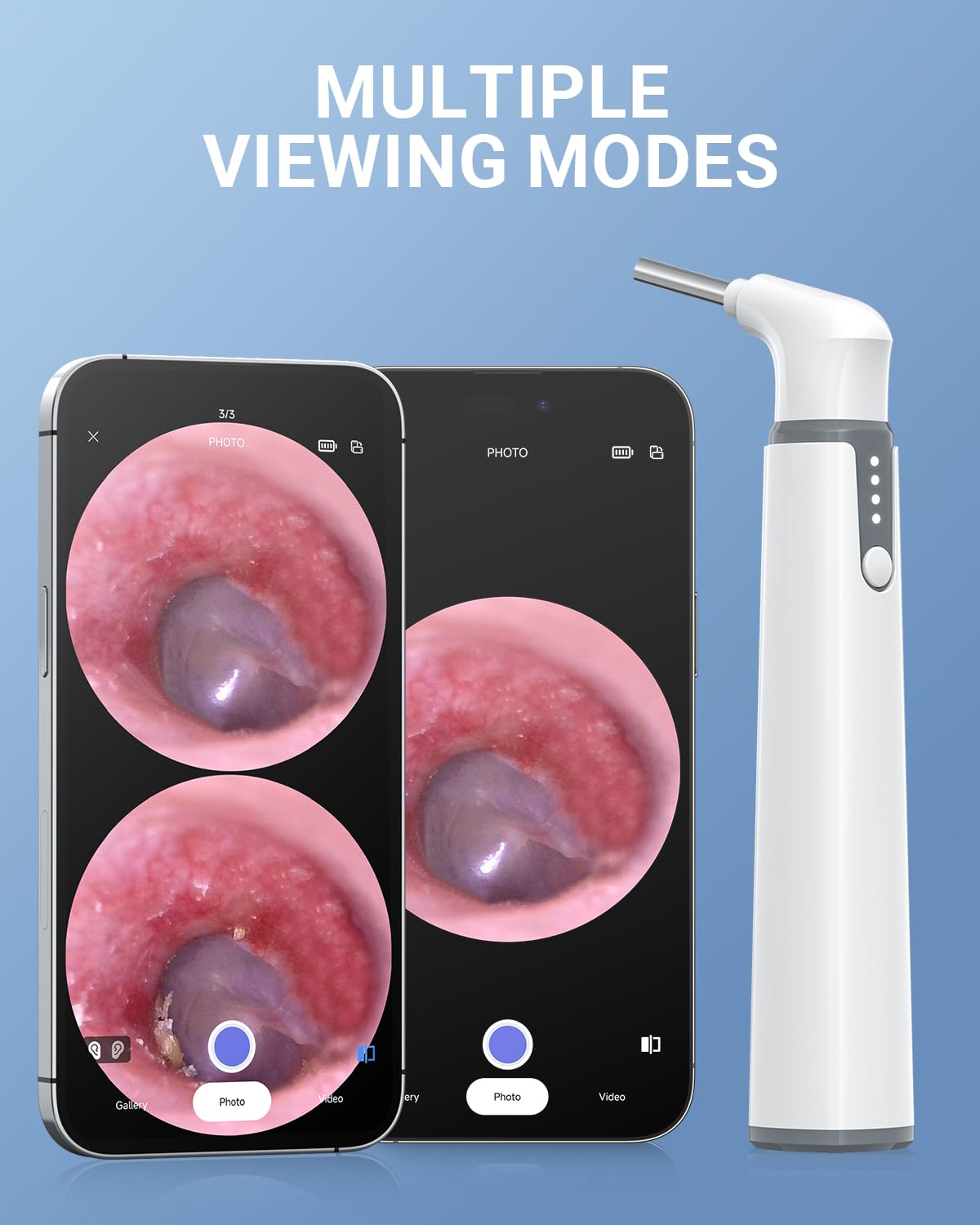 ScopeAround Wireless Otoscope with Light Ear Camera, 3.9mm Ear Wax Removal Tool Camera, 720P HD with 6 LED Lights, WiFi Wireless Otoscope Camera, Ear Scope Compatible with Android and iPhone