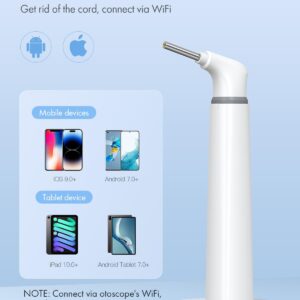 Anykit Wireless Otoscope Ear Camera with Dual View, 3.9mm 720PHD WiFi Ear Scope with Ear Wax Removal Tool for Kids and Adults & Pets, Compatible with Android and iPhone