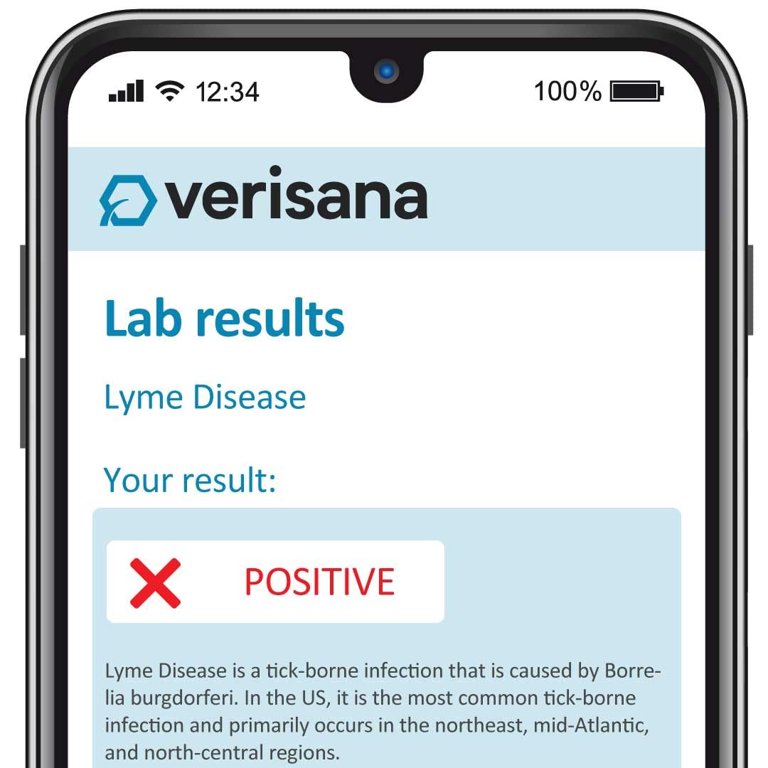 Lyme Disease Test – Determines Reaction to Borrelia Bacteria – Easily & Conveniently from Home –Analysis by CLIA-Certified Lab – Verisana