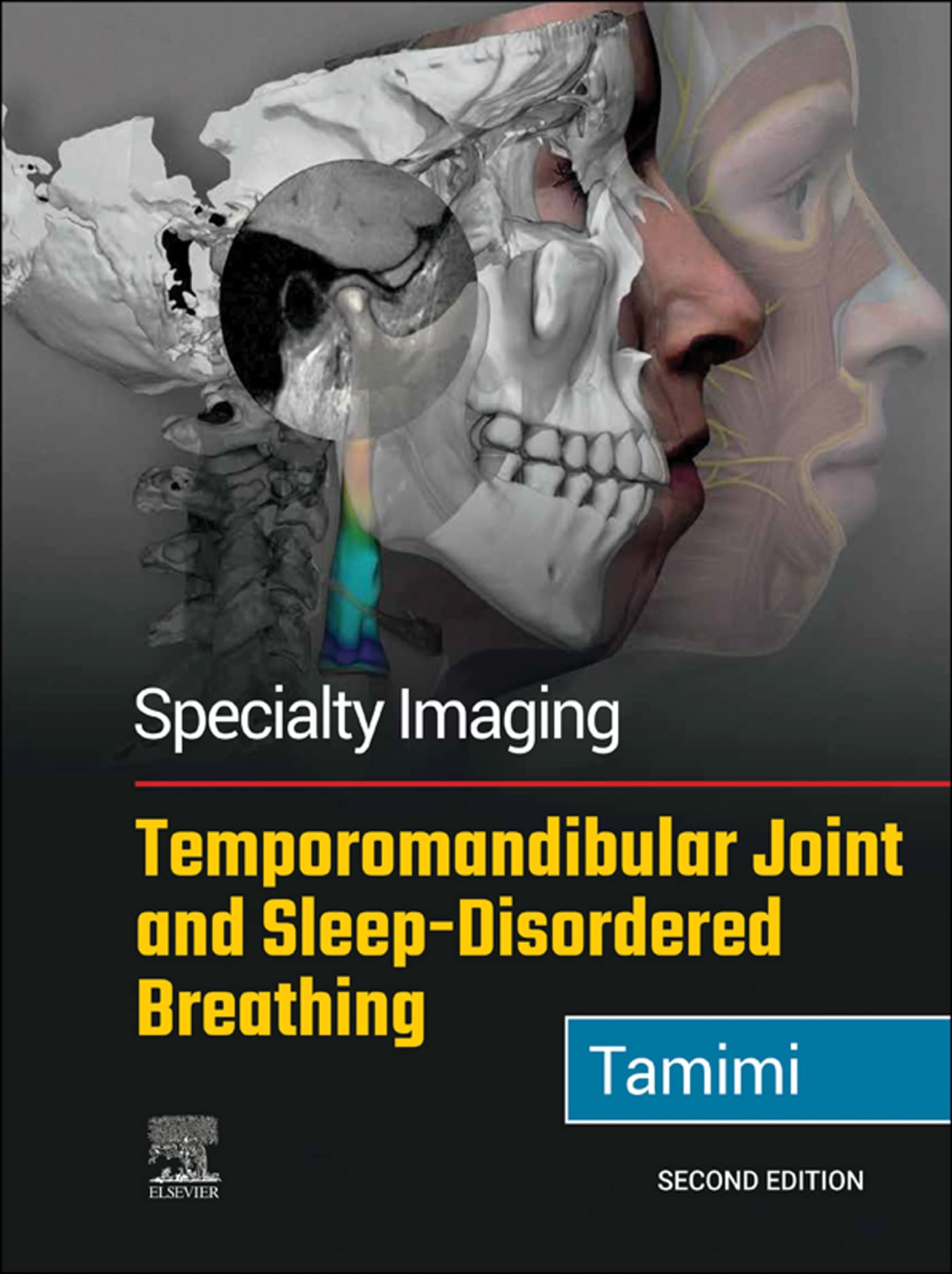 Specialty Imaging: Temporomandibular Joint and Sleep-Disordered Breathing: Specialty Imaging: Temporomandibular Joint and Sleep-Disordered Breathing E-Book