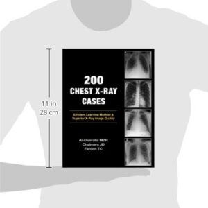 200 Chest X-Ray Cases