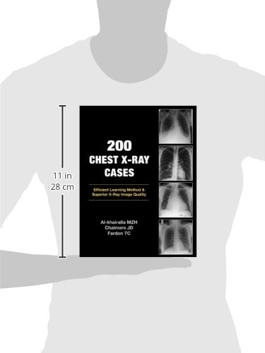 200 Chest X-Ray Cases