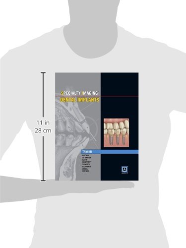 Specialty Imaging: Dental Implants