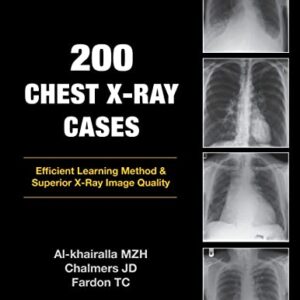 200 Chest X-Ray Cases