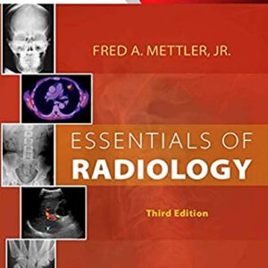 Essentials of Radiology: Common Indications and Interpretation (Mettler, Essentials of Radiology)