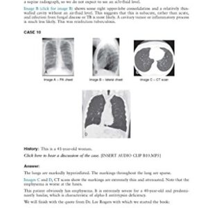 Felson's Principles of Chest Roentgenology, A Programmed Text (Goodman, Felson's Principles of Chest Roentgenology)