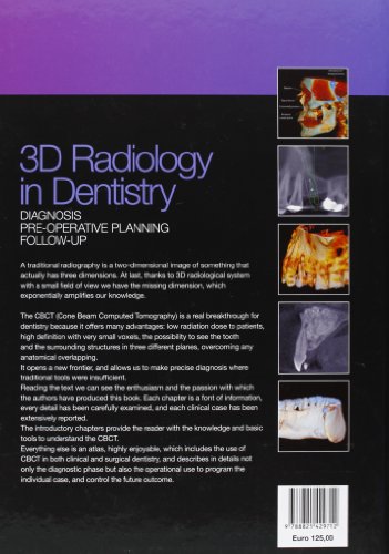 3D radiology in dentistry - Diagnosis Pre-operative Planning Follow-up