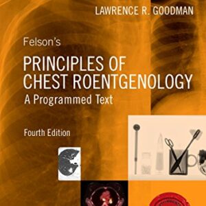 Felson's Principles of Chest Roentgenology, A Programmed Text (Goodman, Felson's Principles of Chest Roentgenology)