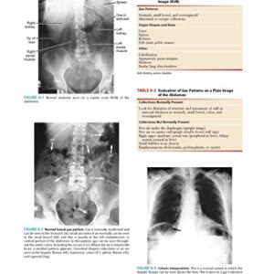 Essentials of Radiology: Common Indications and Interpretation (Mettler, Essentials of Radiology)