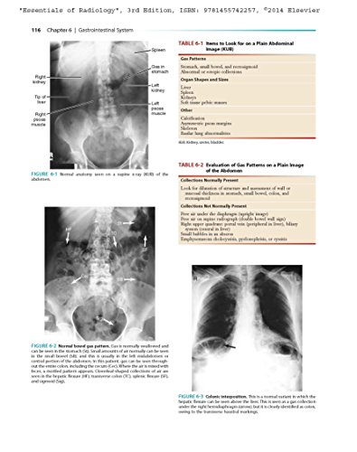 Essentials of Radiology: Common Indications and Interpretation (Mettler, Essentials of Radiology)