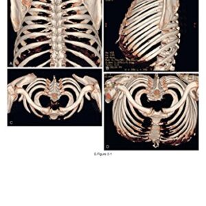 Felson's Principles of Chest Roentgenology, A Programmed Text (Goodman, Felson's Principles of Chest Roentgenology)