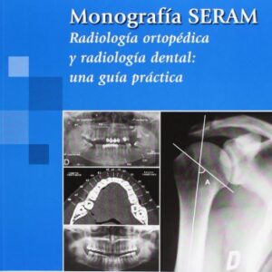 Monografía SERAM: Radiología ortopédica y radiología dental: una guía práctica (Tardáguila / Del Cura) (Spanish Edition)