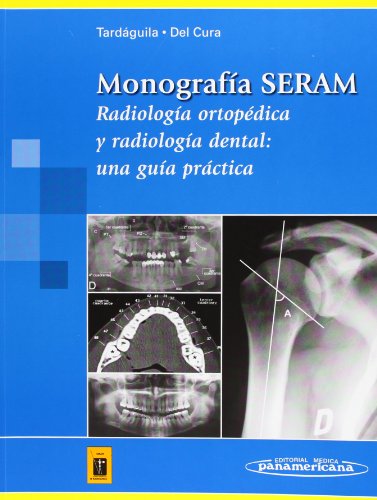 Monografía SERAM: Radiología ortopédica y radiología dental: una guía práctica (Tardáguila / Del Cura) (Spanish Edition)