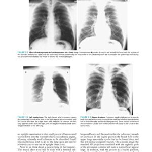 Essentials of Radiology: Common Indications and Interpretation (Mettler, Essentials of Radiology)