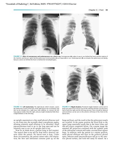 Essentials of Radiology: Common Indications and Interpretation (Mettler, Essentials of Radiology)