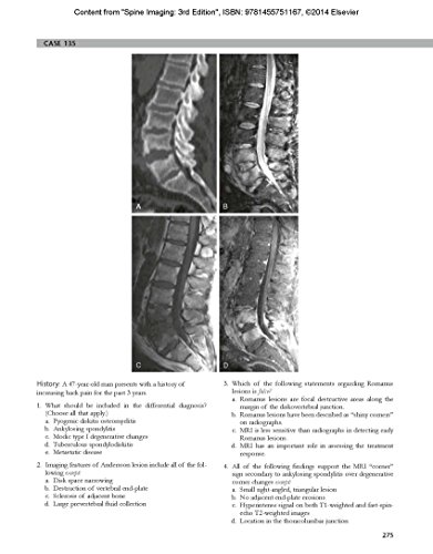 Spine Imaging: Case Review Series: Expert Consult - Online and Print