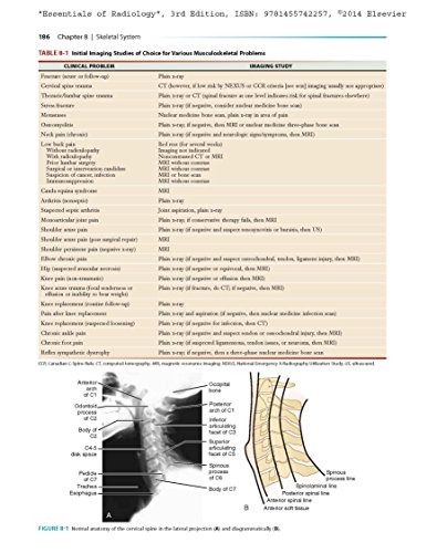 Essentials of Radiology: Common Indications and Interpretation (Mettler, Essentials of Radiology)