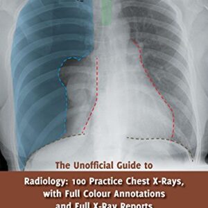 The Unofficial Guide to Radiology: 100 Practice Chest X Rays with Full Colour Annotations and Full X Ray Reports (Unofficial Guides)