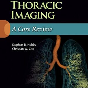 Thoracic Imaging: A Core Review