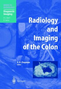 radiology and imaging of the colon (diagnostic imaging)