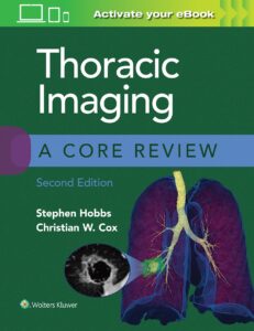 thoracic imaging: a core review