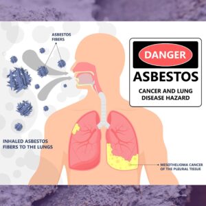 PRO-LAB Asbestos Test Kit - (2 Samples) Emailed Results Within 3 to 5 Business Days - Includes Return Mailer and Expert Consultation. Optional Lab Fee for NVLAP Analysis