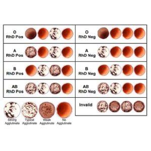 Eldoncard Blood Typing Kit, 5 Test Pack, Know Your Blood Type, Accurate Instant Home Testing, Determine A, O, B, Rhs-D Negative & Positive Groups