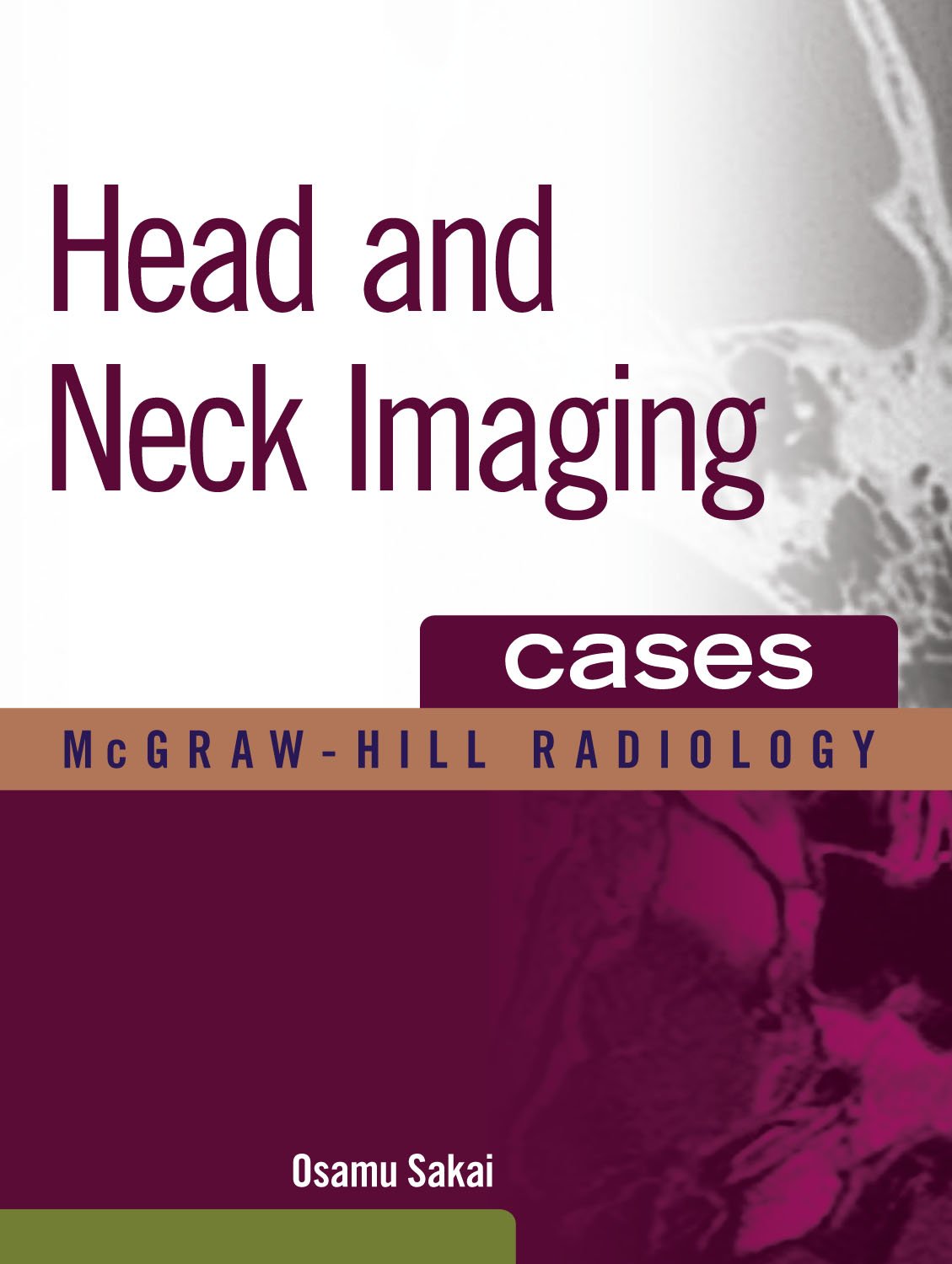 Head and Neck Imaging Cases (The Mcgraw-hill Radiology Series)