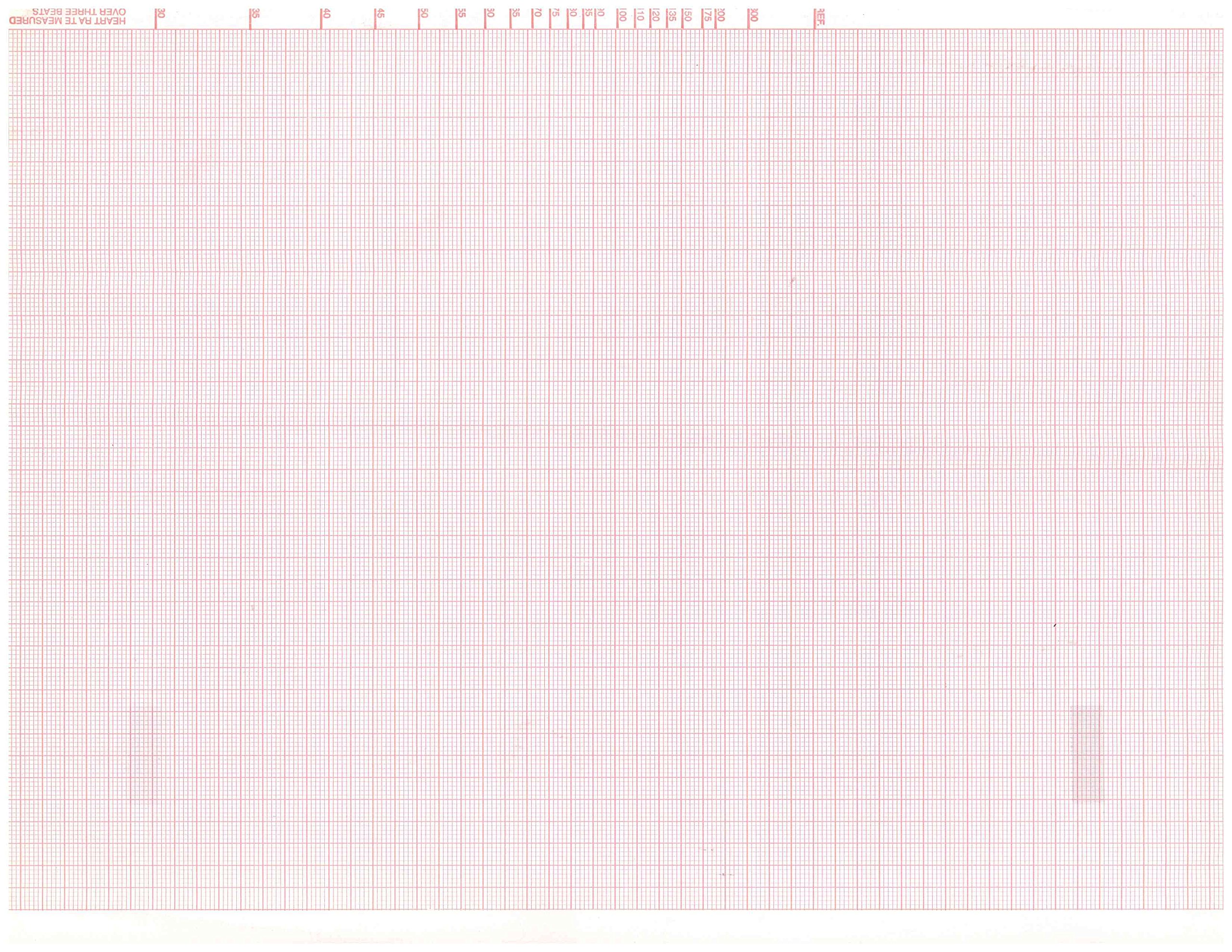 ECG/EKG Paper for Mortara ELI 200-215mm X 280mm, Z-fold (10 Packs/Box)