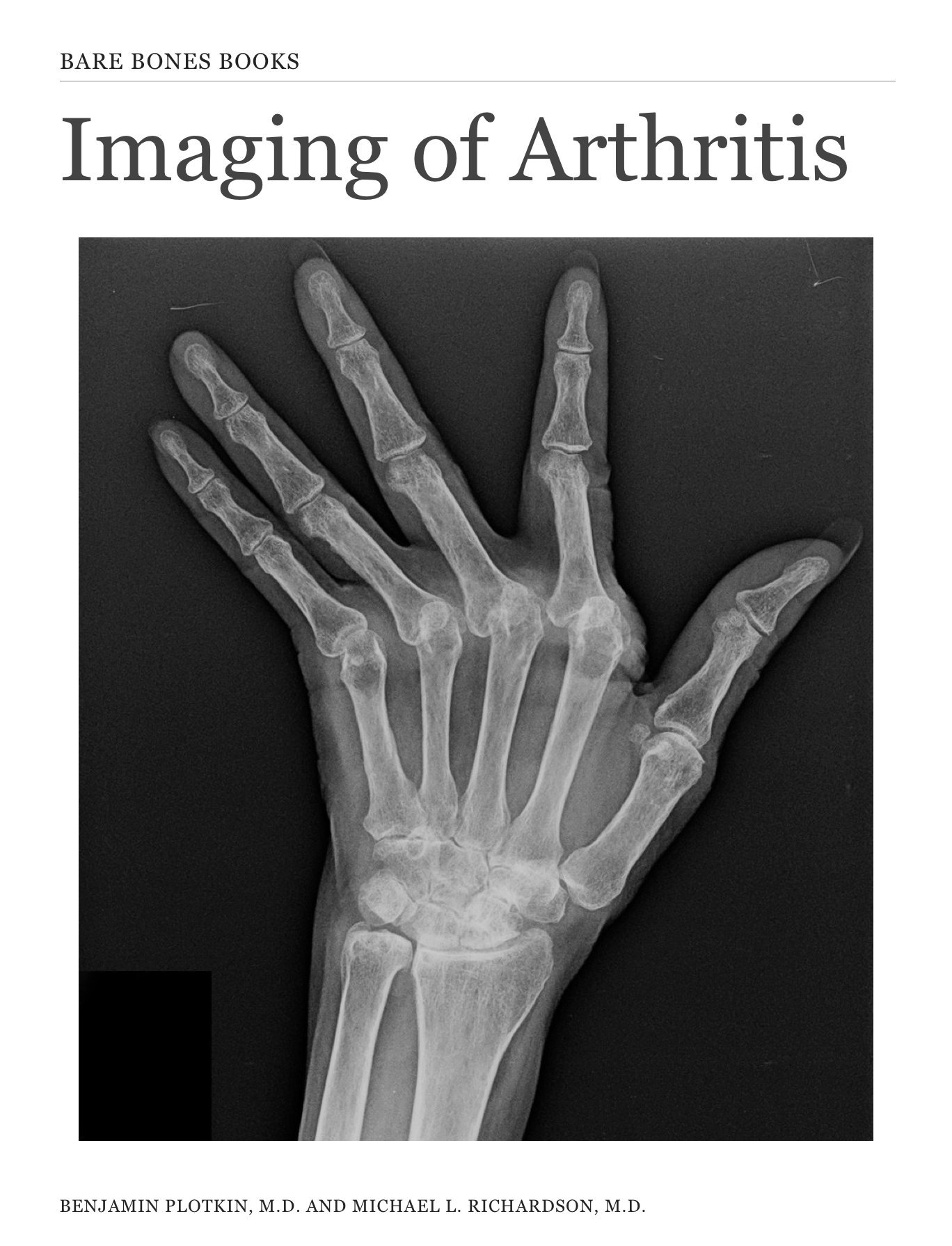 Imaging of Arthritis