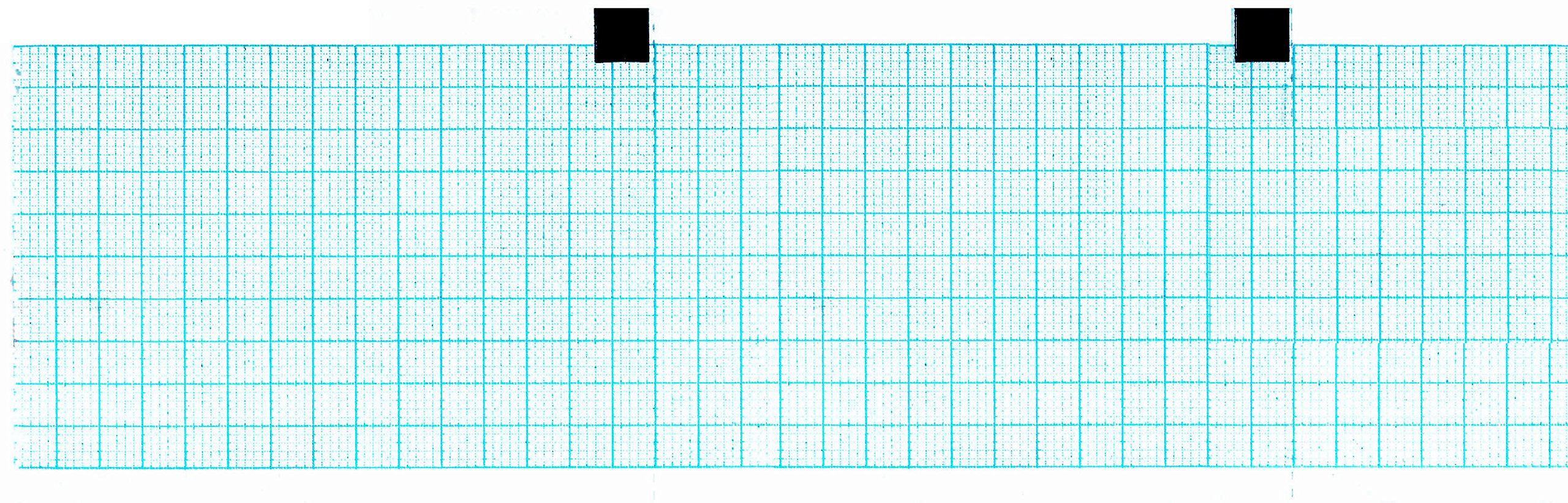 ECG Paper 60MM X 15M Blue Grid, DOT-Card (Works for CARDIETTE AR600 ADV, 66010037) (5)